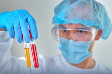Koronavirüs COVID19, HIV, ebola ya da diğer tehlikeli enfeksiyonlar için kan testi yapan maskeli bir doktor. Tıbbi geçmiş, enstrümanlar, şablon, duvar kağıdı. Coronavirus hastalığı konsepti