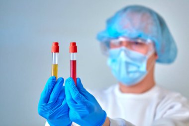 Kan testi tüpleri, koronavirüs COVID19, HIV, ebola veya diğer tehlikeli enfeksiyonları tutan maskeli bir doktor. Tıbbi geçmiş, enstrümanlar, şablon, duvar kağıdı. Coronavirus hastalığı konsepti. Doktor portresi