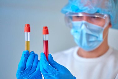 Kan testi tüpleri, koronavirüs COVID19, HIV, ebola veya diğer tehlikeli enfeksiyonları tutan maskeli bir doktor. Tıbbi geçmiş, enstrümanlar, şablon, duvar kağıdı. Coronavirus hastalığı konsepti. Doktor portresi