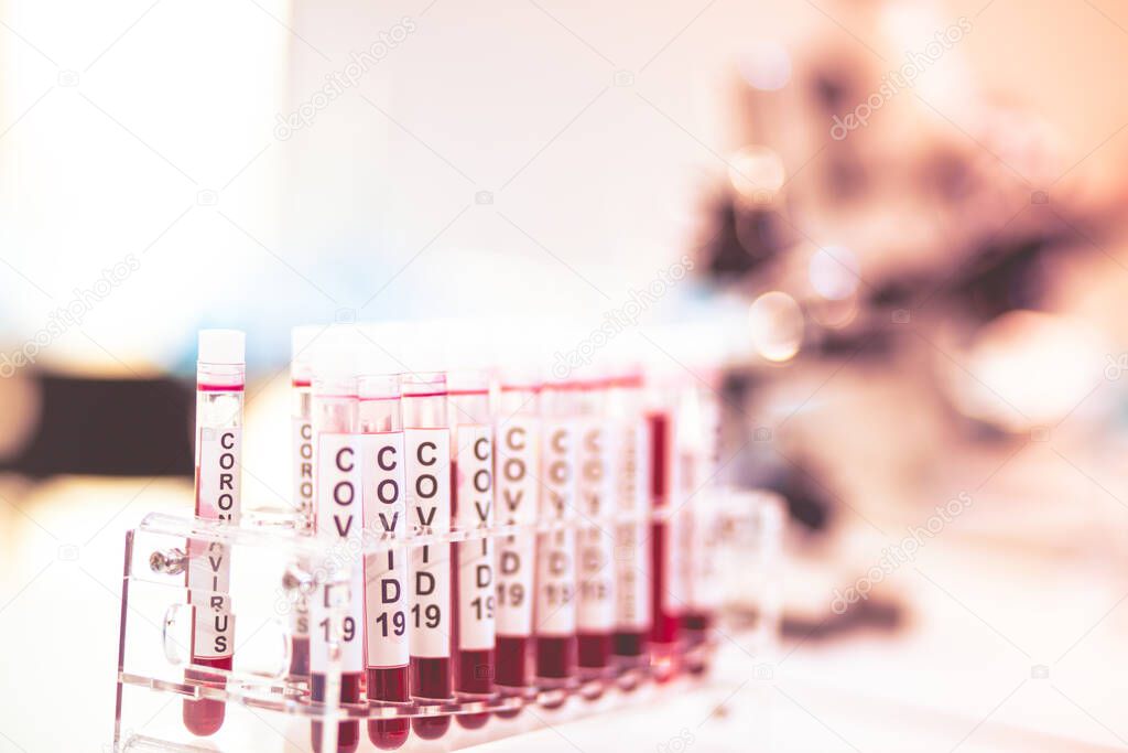 Focus one blood sample in the tube. Close-Up on Covid 19 blood tube for Vaccine research in Laboratory on background of Scientific Lab.