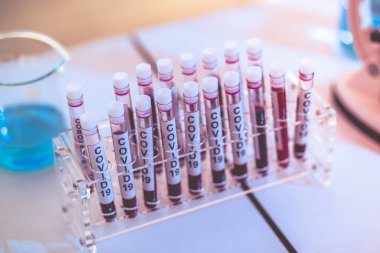 Tüpteki bir kan örneğine odaklan. Laboratuvarda bilimsel laboratuvarın arka planında aşı araştırması için Covid 19 kan tüpüne yakın çekim.