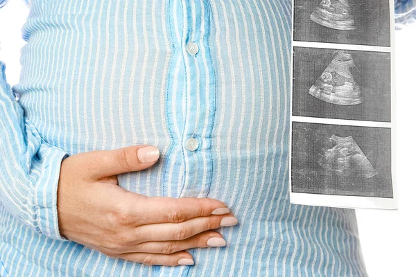 Lycklig gravid flicka ligger på vit bakgrund — Stockfoto