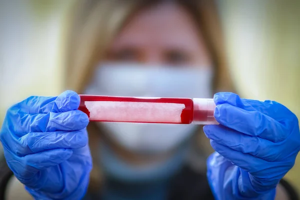 Test Sanguin Coronavirus Chez Une Fille Entre Les Mains 2019 — Photo
