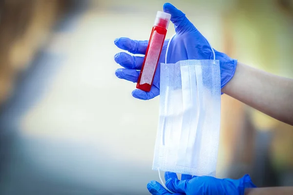 Nas Mãos Tubo Teste Com Sangue Para Análise Vírus Covid — Fotografia de Stock