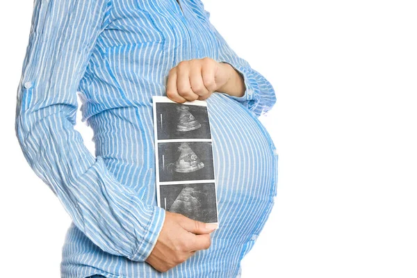 快乐的怀孕女孩 手上拿着超声波 背景为白色 对妇女和儿童的积极保护 — 图库照片