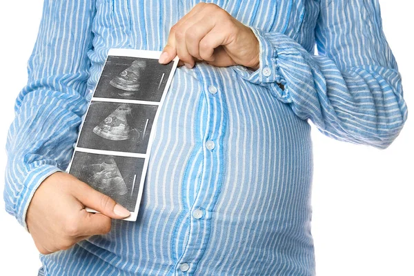 Menina Grávida Feliz Com Ultra Som Nas Mãos Fundo Branco — Fotografia de Stock