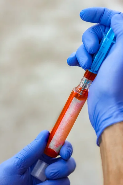 Las Manos Tubo Ensayo Con Sangre Para Análisis Del Virus —  Fotos de Stock