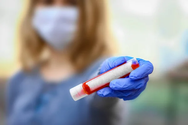 Analisi Del Sangue Coronavirus Una Ragazza Nelle Mani 2019 2020 — Foto Stock