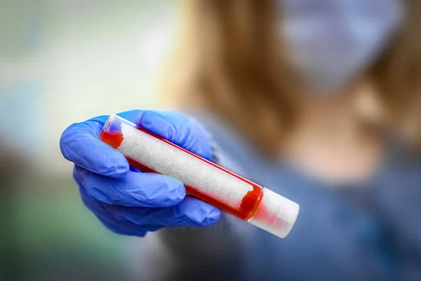 手の中の女の子のコロナウイルスの血液検査2019 2020 クラウンウイルス発生 流行性ウイルス呼吸器症候群 — ストック写真