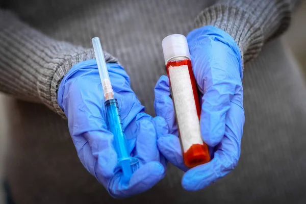 Coronavirus Kan Testi 2019 2020 Arası Bir Kızda Yapılmış Crown — Stok fotoğraf