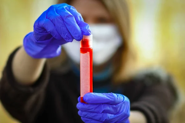 2019年至2020年 在手上的一个女孩身上做了Coronavirus血液检测 皇冠病毒爆发 流行性病毒性呼吸道综合征 — 图库照片