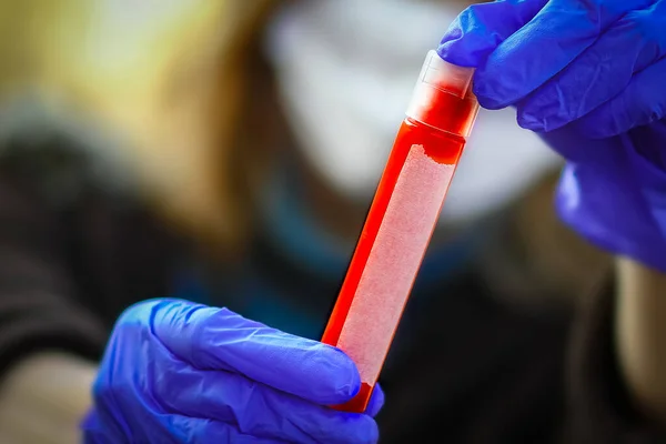 Teste Sangue Coronavírus Uma Menina Nas Mãos 2019 2020 Surto — Fotografia de Stock