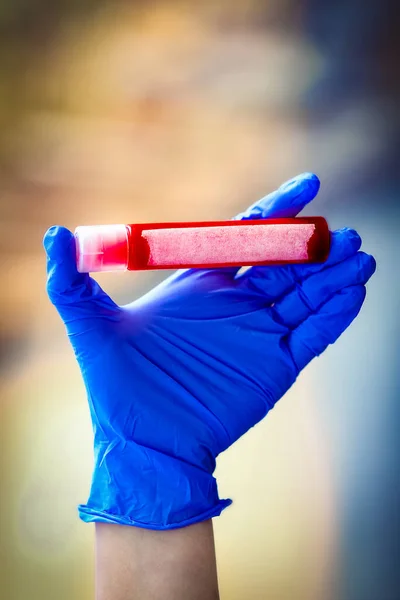 ウイルスの分析のための血液と試験管の手の中に Covid 19は感染性空気人口の危険性がある — ストック写真