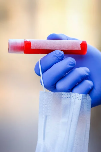 Руках Тестової Трубки Кров Аналізу Вірусу Ковід Небезпечним Інфекційного Населення — стокове фото