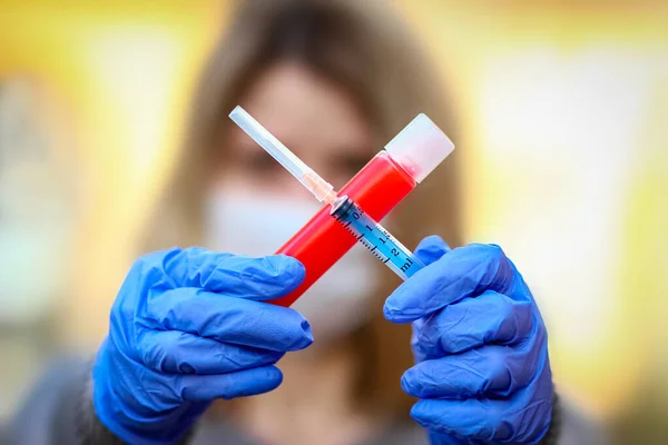 Nas Mãos Tubo Teste Com Sangue Para Análise Vírus Covid — Fotografia de Stock