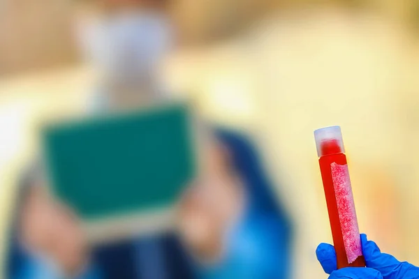 Коронавірус Крові Руках 2019 2020 Вірус Корони Епідемічний Вірусний Респіраційний — стокове фото