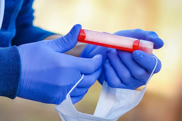 Руках Тестової Трубки Кров Аналізу Вірусу Ковід Небезпечним Інфекційного Населення — стокове фото
