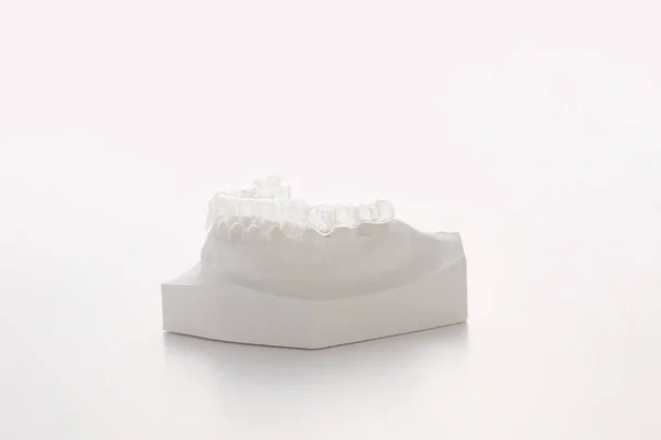 Dental Model Transparent Dental Aligner Isolated White Background Copy Space — Stock Photo, Image