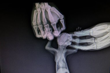 X-ray images of wild animal clipart