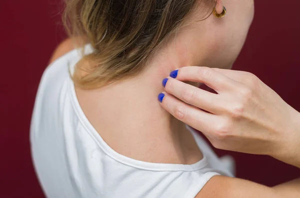 Geweldig Concept Van Allergie Huid Ziekten Jonge Vrouw Zichzelf Krabben — Stockfoto