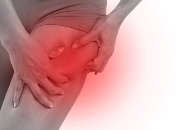 aşırı bacak fat veya selülit tutan kadının el