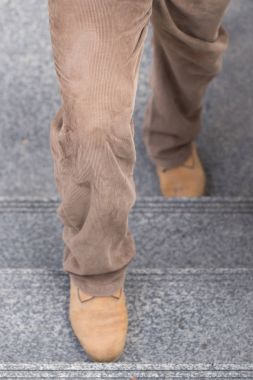 diz eklem ağrısı kavramı, merdivenlerde hızlandırılması bacak