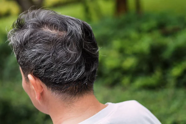 Vieil homme âgé ou d'âge moyen avec un problème de cheveux gris — Photo