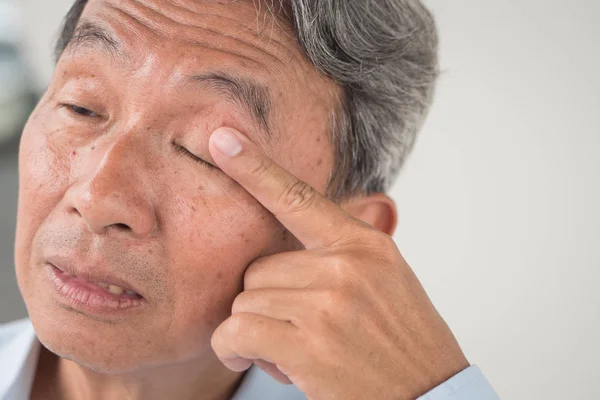 Gammel mand med øjenirritation, optisk problem - Stock-foto