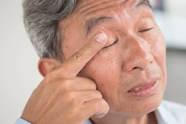 Hombre viejo con irritación ocular, problema óptico — Foto de Stock