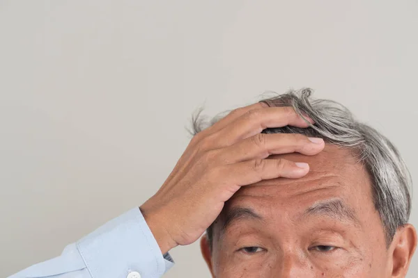 Anciano jubilado preocupado con problemas de envejecimiento del cabello gris — Foto de Stock