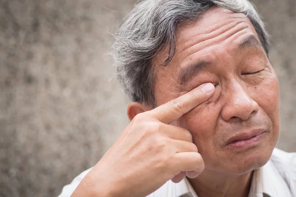 Hombre viejo con irritación ocular, problema óptico — Foto de Stock