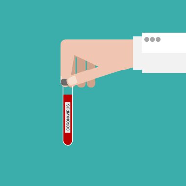 Covid-19 ro Coronavirus. Salgınla savaşmak için ilaç. Araştırmacının elinde salgınla savaşmak için üzerinde korona virüsü, analiz ya da ilaç bulunan bir test tüpü var.