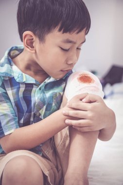 Çocuk yaralandı. Bandaj ile çocuğun diz yara. Vintage sesi.