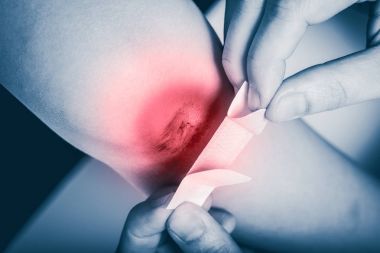 Anne İlkyardım yara, oğlu bacak ile kırmızı spot sore sağlar