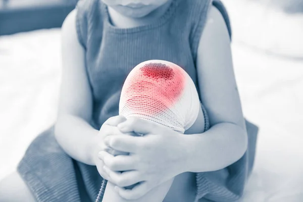Bambino ferito. Ferito sul ginocchio di un bambino con una benda. Concetto di sanità e medicina umana . — Foto Stock