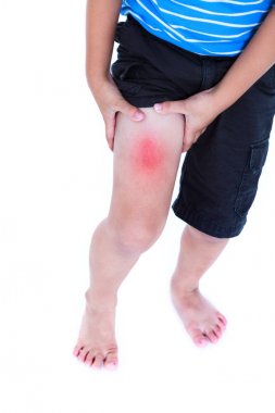 Uyluk yaralı çocuk portre. Beyaz arka plan üzerinde izole.