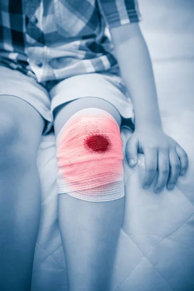 Criança ferida. Ferida no joelho da criança com bandagem. Conceito de saúde humana e medicina . — Fotografia de Stock