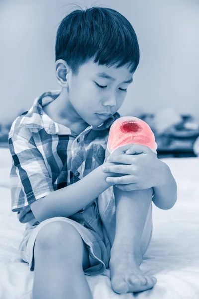 Niño herido en la rodilla. Los niños han sido un accidente — Foto de Stock