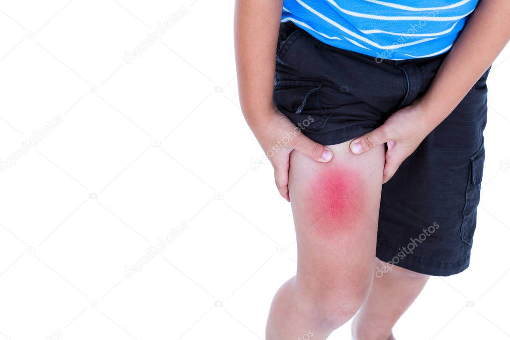 Closeup of child injured at thigh. Isolated on white background.