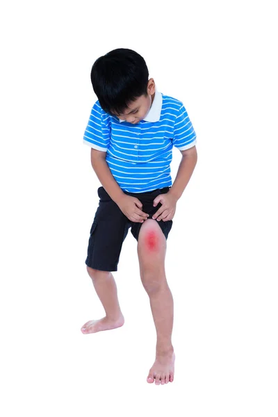Cuerpo completo de niño asiático lesionado en el muslo. Aislado sobre fondo blanco . —  Fotos de Stock