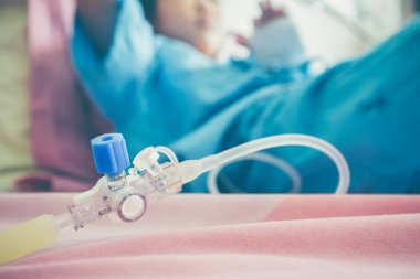 El closeup IV hortum hasta için ayarlayın. Sağlık bakım hikayeler.