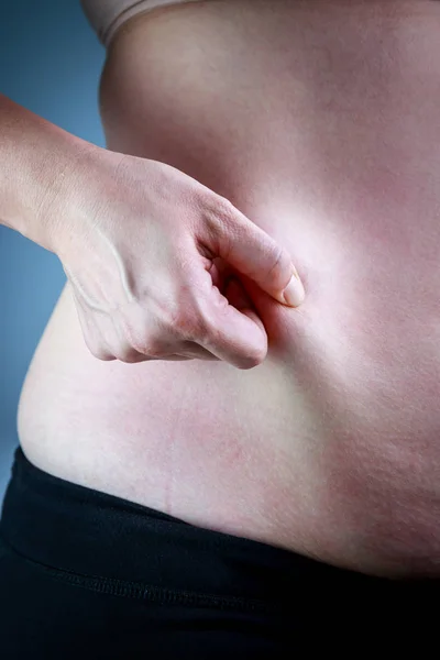 Close up female checking fat on abdomen, grey background. — Stock Photo, Image