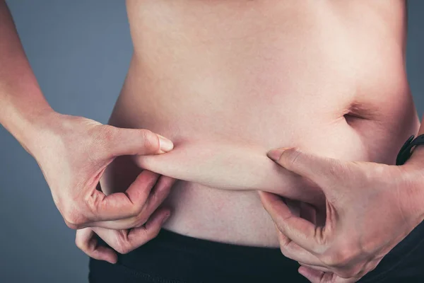 腹部、灰色の背景に女性チェック脂肪を閉じる. — ストック写真