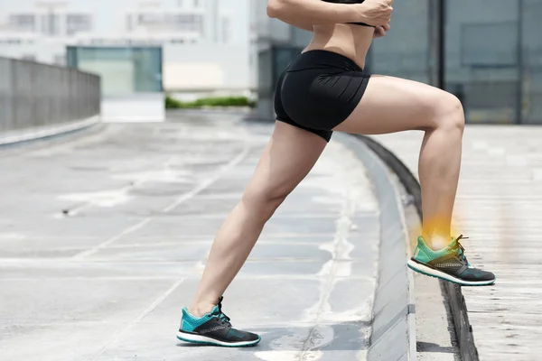 Woman Training Outdoors Painful Leg — Stock Photo, Image