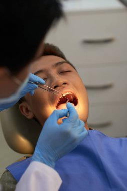 Genç adam her diş Doktor muayene edeyim ağzını açma