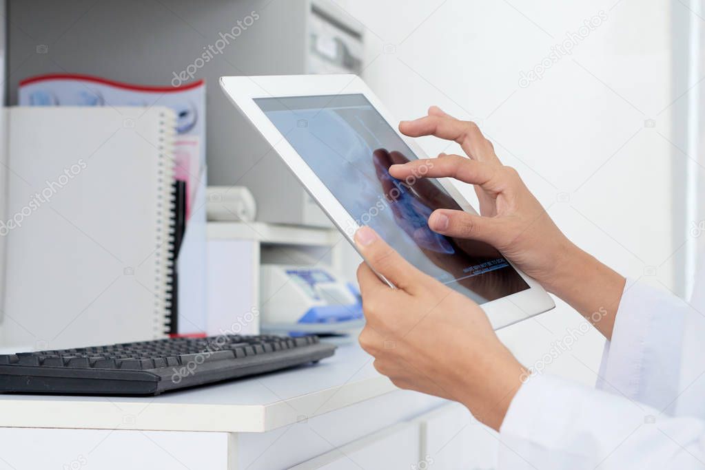 Hands of nurse examining jaw x-ray on the screen of digital tablet