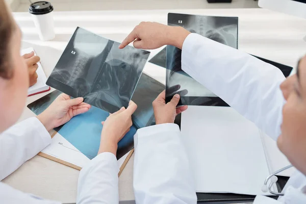 Imagen Cerca Los Trabajadores Salud Discutiendo Radiografías Tórax Garganta Pacientes —  Fotos de Stock