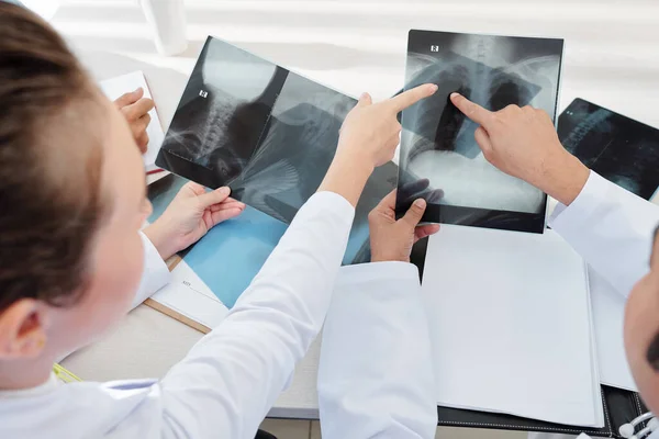 Médecins Pointant Vers Radiographie Pulmonaire Patient Atteint Une Infection Par — Photo