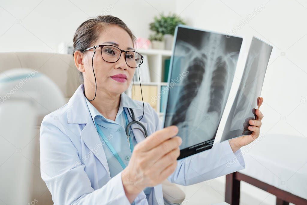 Serious mature Vietnamese woman examining chest x-rays of patient with suspected pneumonia