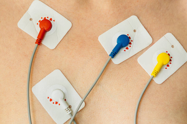Close up of Woman wearing holter monitor. Device for daily monitoring of an electrocardiogram. Treatment of heart diseases